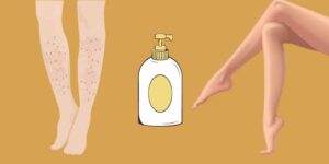 Best Lotion for Extremely Dry Skin on Legs: Do this Instead!